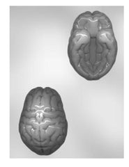 3D Brain Chocolate Mold - 4"